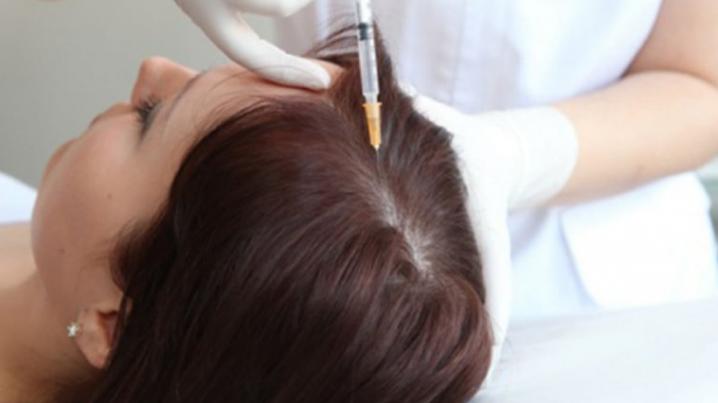 Mezoterapi İle Saç Güçlendirme